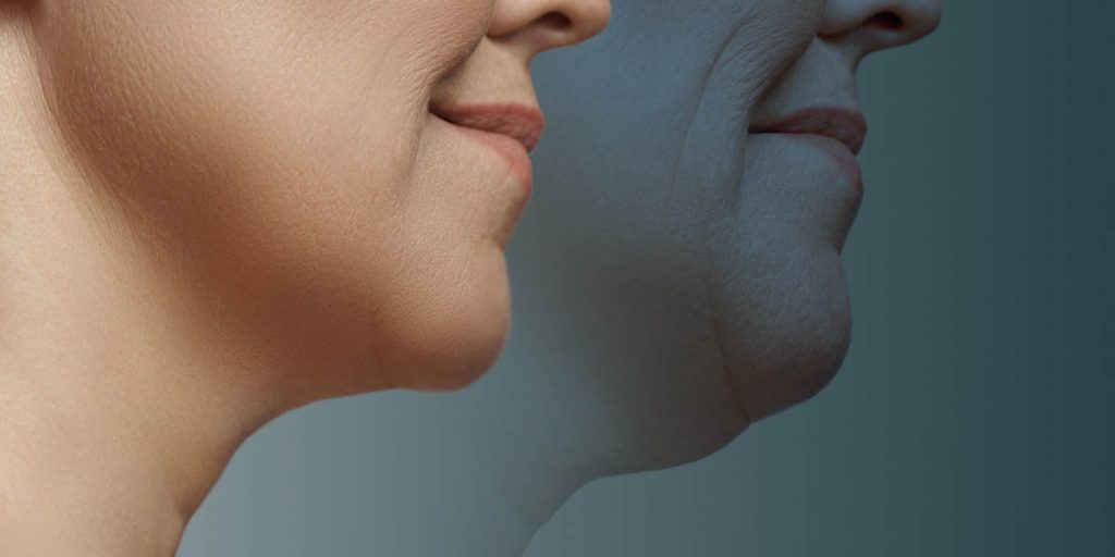 How To Remove Double Chin