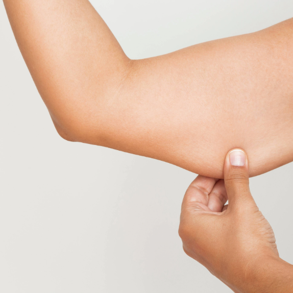 arms whole body lipo