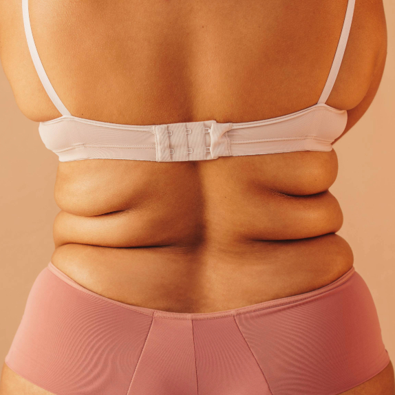 back bra rolls