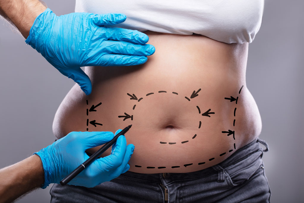 full body lipo new york ultrasound