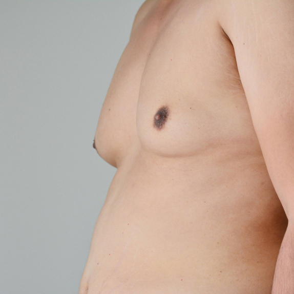 male chest