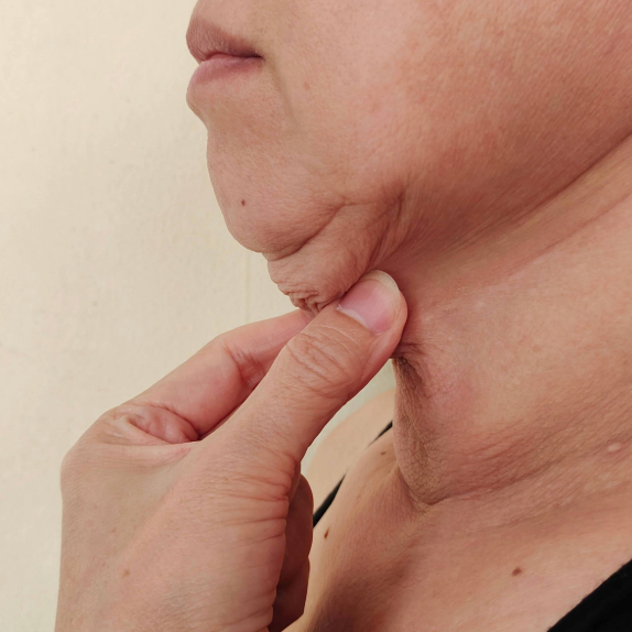neck under chin