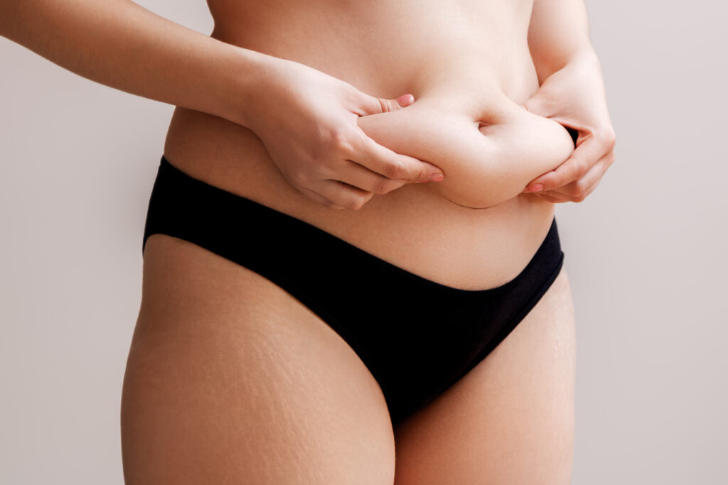 Fat woman hand holding excessive belly fat . Healthcare and woman diet lifestyle concept to reduce belly and shape up healthy stomach muscle .