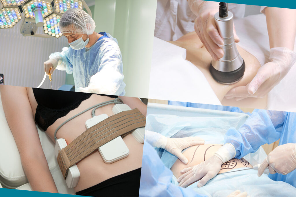 lipo laser. Hardware cosmetology. Body care. Non surgical body s