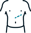Quick Recovery with Discreet Incisions