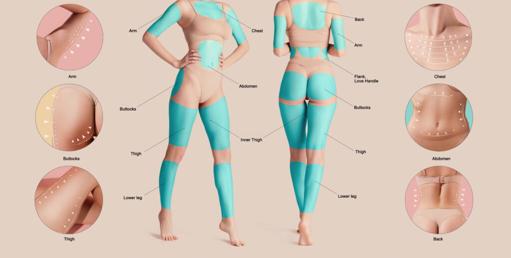 Poster with female body with marked areas for lifting procedures. Base fat problems areas of human body.