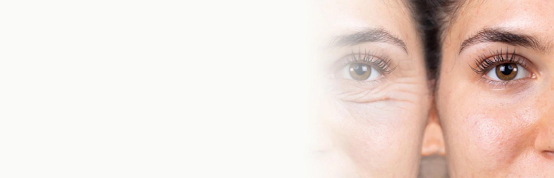 blepharoplasty surgery benefits