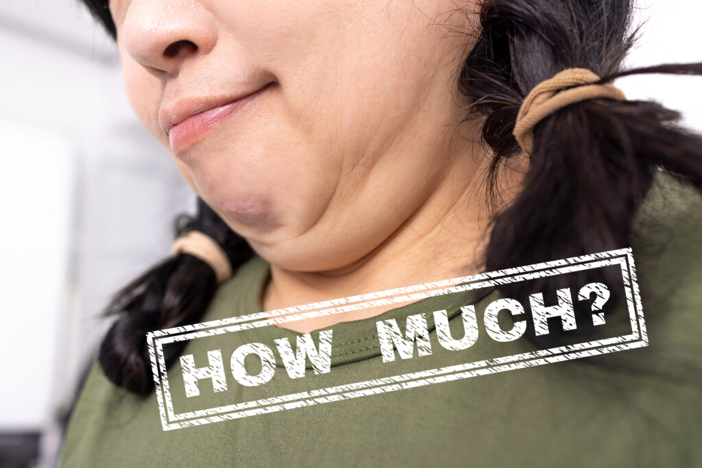 fat woman with double chin