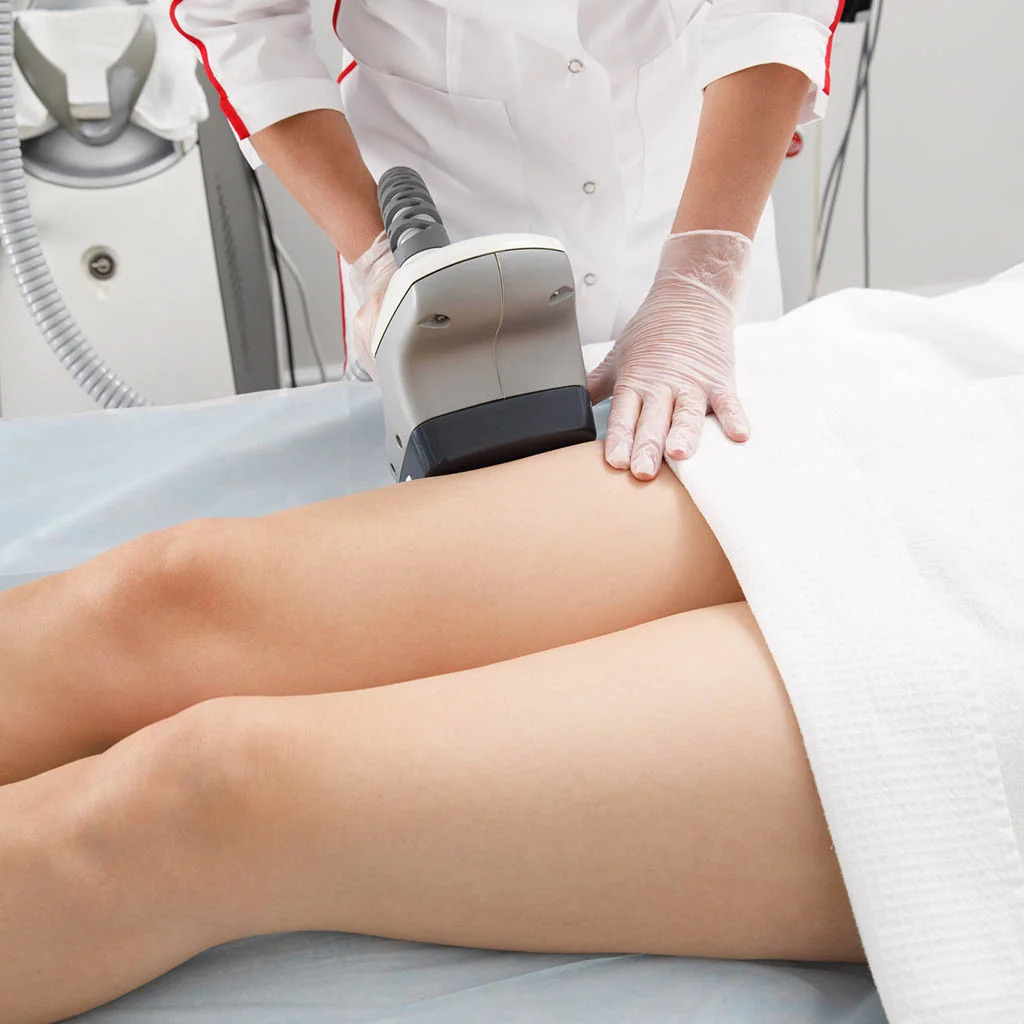 Laser Assisted Liposuction (Smart Lipo)