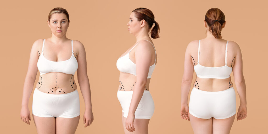 Overweight woman on color background. Weight loss concept