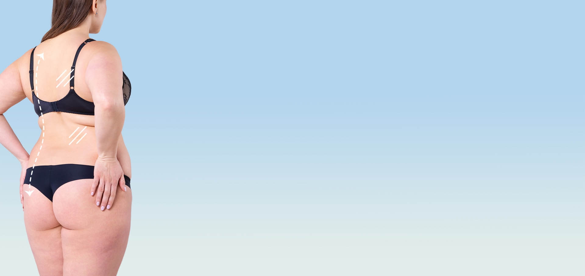 Back liposuction NYC