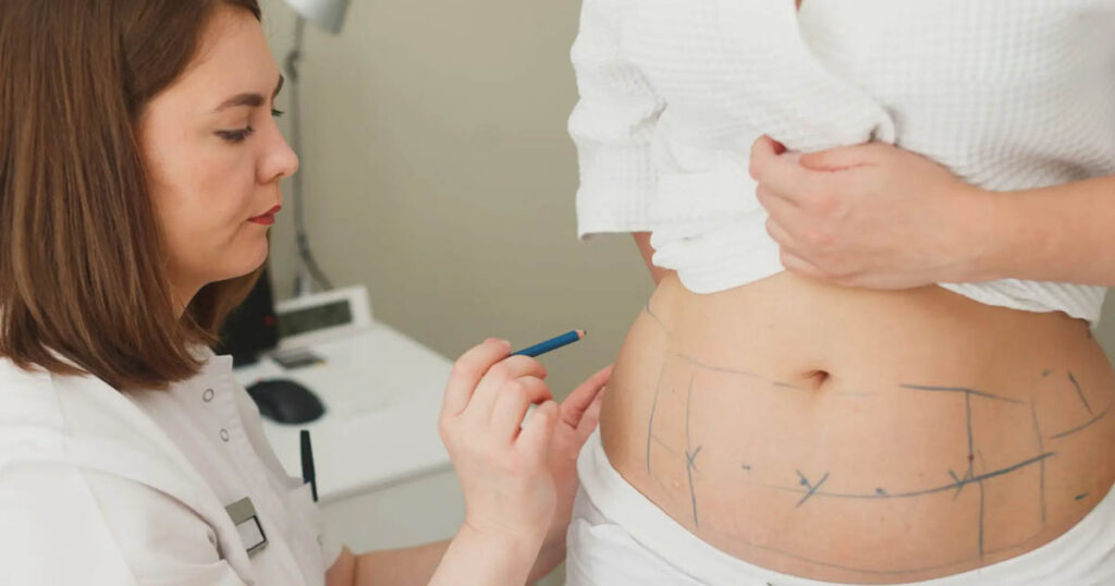 Lipo 360 Recovery Time How Long Does It Take to Heal