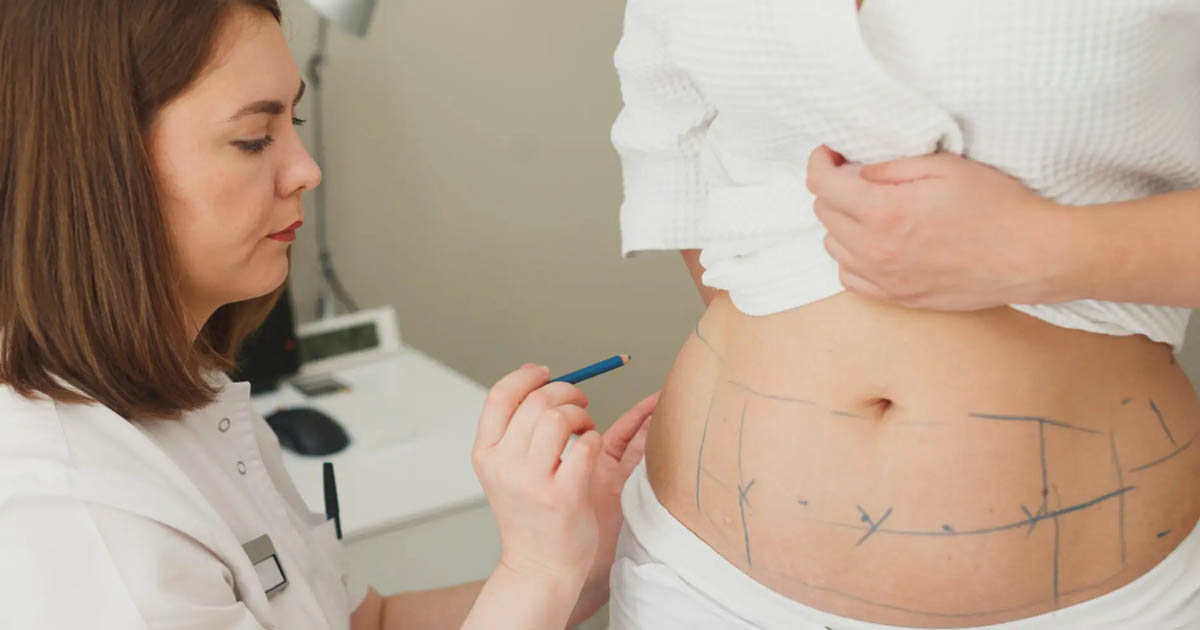 Lipo 360 Recovery Time How Long Does It Take to Heal