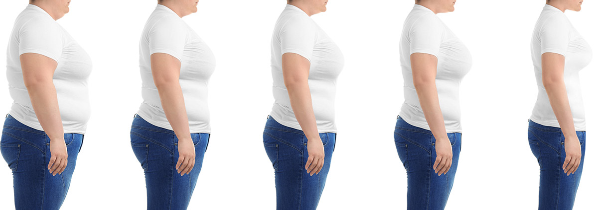 liposuction recovery time