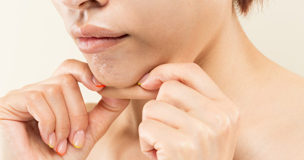 jaw liposuction cost