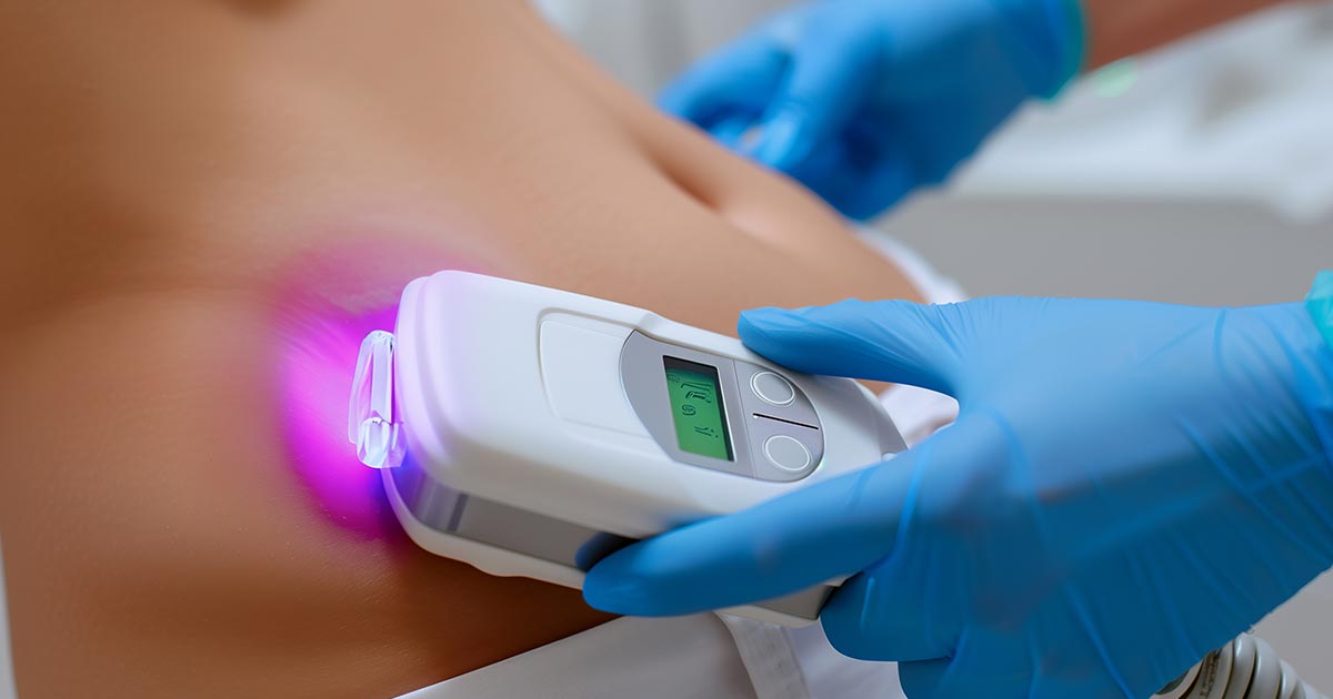 Expert Tips to Ensure a Safe Liposuction Procedure