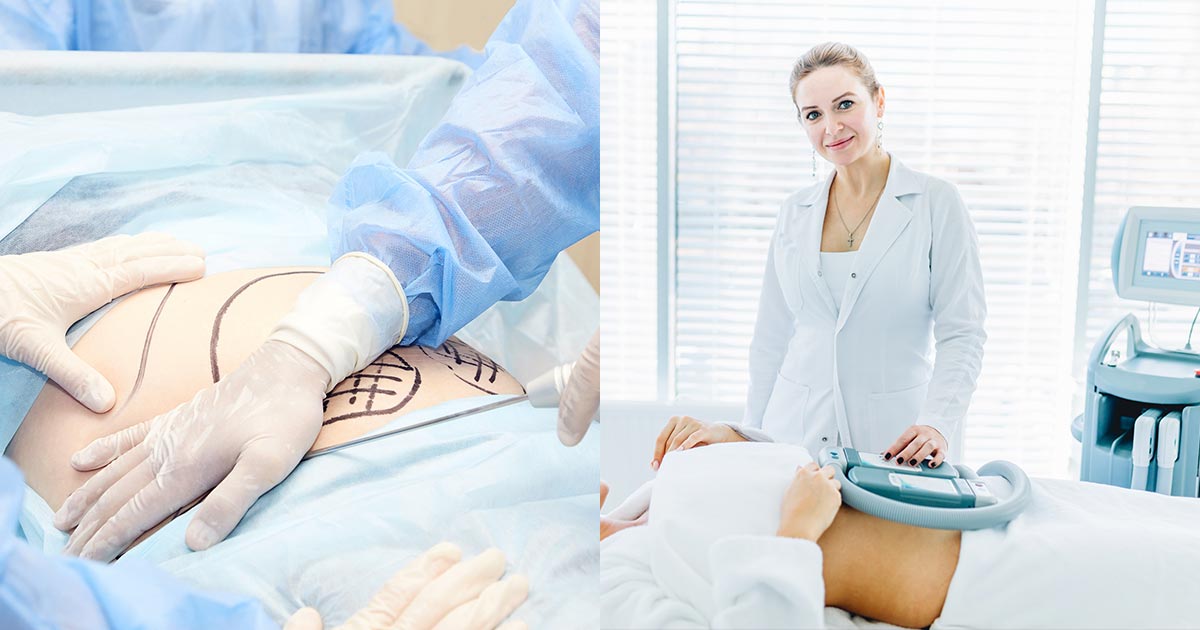 How Safe is Liposuction Compared to Non Surgical Liposuction